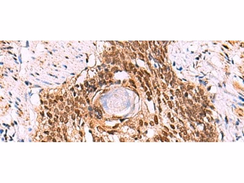 What are LIM proteins homologous domains?